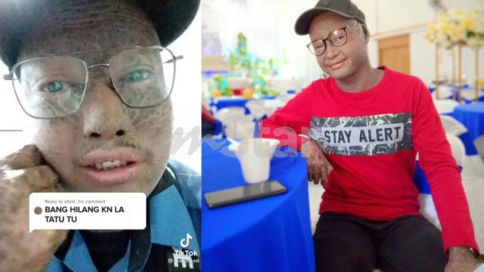 Abang guard kulit ‘bersisik’ suka buat video Tiktok waktu malam, ada yang kata terkena sumpahan – “Tak perlu kaitkan ibu, arwah ayah saya” – Viral | mStar_6084fc6c36f1c.jpeg