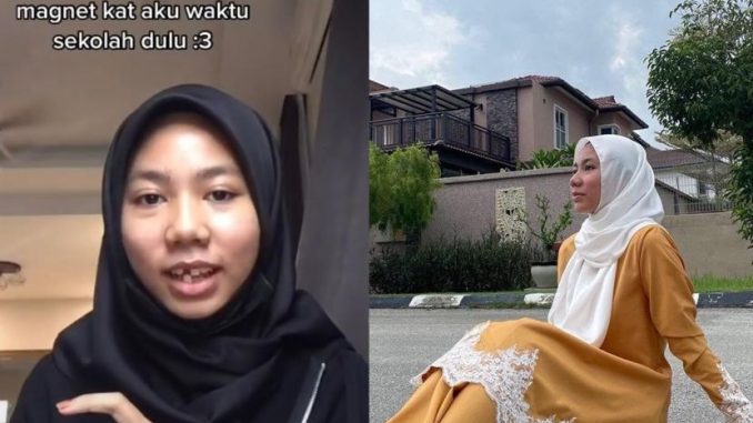 Lebih 4 tahun ‘rompong’, semuanya gara-gara magnet… apa yang berlaku sebenarnya sampaikan remaja ini terpaksa pakai gigi palsu? – Viral | mStar_60baf56a3dee8.jpeg