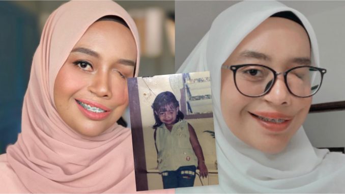 ‘Mulvt Orang Takkan Berhenti Menilai..’ Ini Surv1val G4dis Tanpa Sebelah M4ta_610fd17269426.jpeg