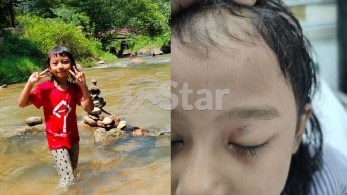 Bapa nampak ular ‘target’ anak sedang mandi air terjun tapi tak sempat bertindak, tiba-tiba dah kena patuk 2 kali – “Dua klinik tak terima kes ni” – Viral | mStar_613ac47da99fe.jpeg